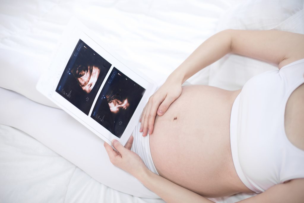 pregnancy, беременность, pregna-5, pregna5, 35 неделя беременности